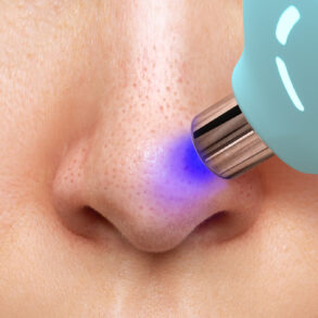 FOREO KIWI pore vacuum on the nose