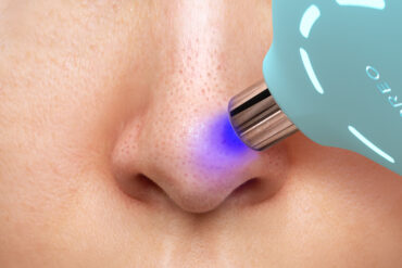 FOREO KIWI pore vacuum on the nose
