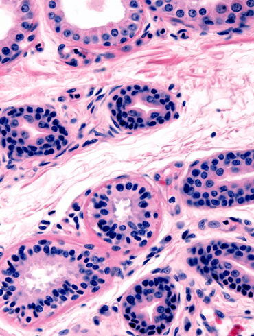 Microscopic view of secretory units of apocrine and eccrine sweat glands